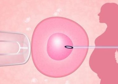 做泰国试管婴儿有哪些步骤？