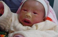 2026金华试管费用一般多少钱？